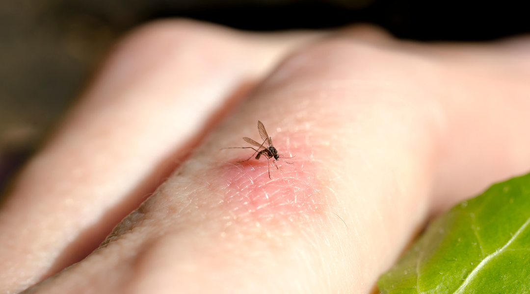 Picaduras nocturnas: cómo reconocerlas y saber si hay una plaga en casa